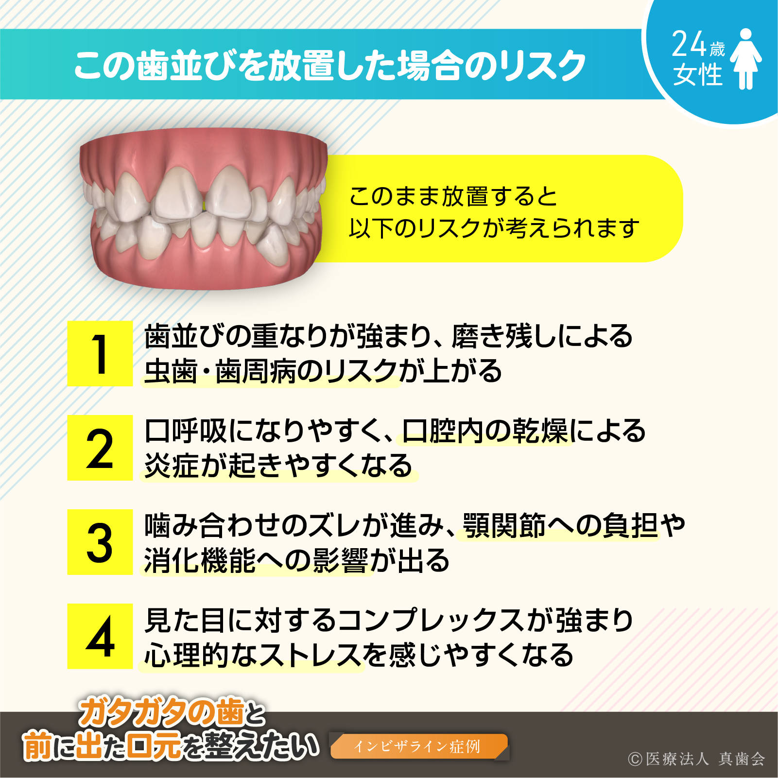 この歯並びを放置した場合のリスク